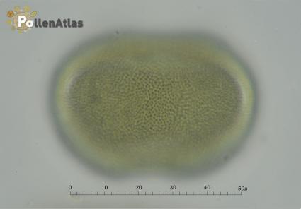Asphodelus microcarpus
