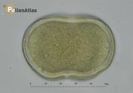 Asphodelus microcarpus