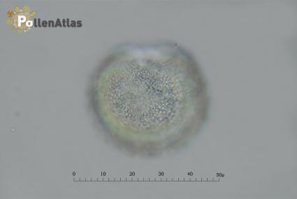 Hyacinthus orientalis pollen equatorial view tangent rear