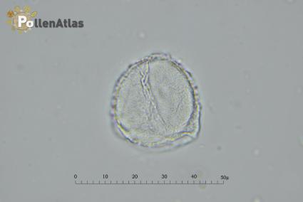 Magnolia x soulangeana pollen
