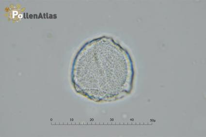 Magnolia x soulangeana pollen