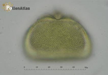 Asphodelus microcarpus