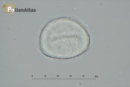 Magnolia x soulangeana polar view tangent front