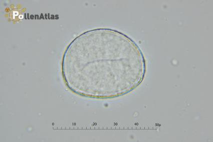 Magnolia x soulangeana polar view secant rear