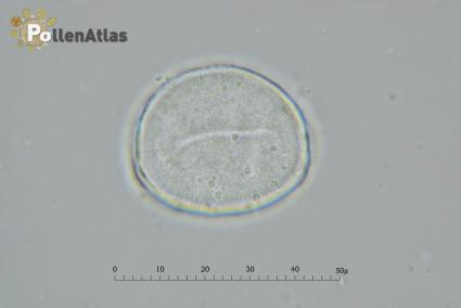 Magnolia x soulangeana polar view tangent rear